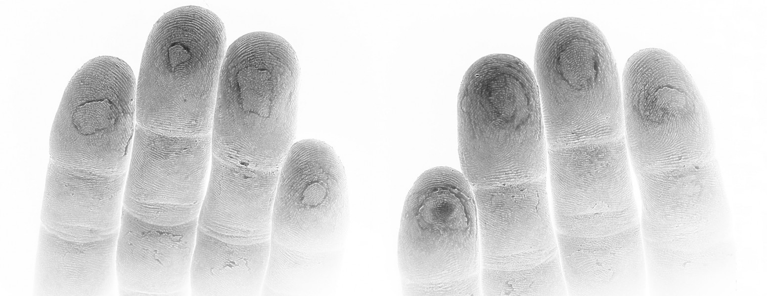 Worn fingertips after climbing, Little Gorge in Pyli, Trikala, Thessalia, Greece. August 2004.